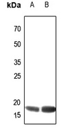 ATP5H Rabbit Polyclonal Antibody