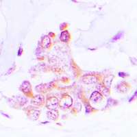 ATP5H Rabbit Polyclonal Antibody