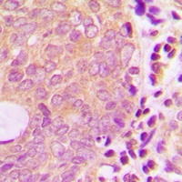 Anti-ATP7B Antibody