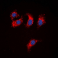 ATP7B antibody