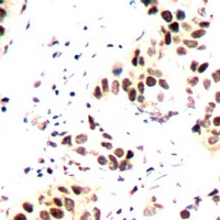 Aurora B Antibody