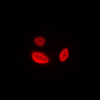 Aurora B Antibody