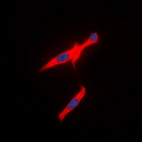 AVPR2 antibody