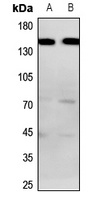BAI1 Rabbit Polyclonal Antibody