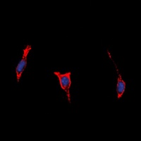 BAI1 Rabbit Polyclonal Antibody