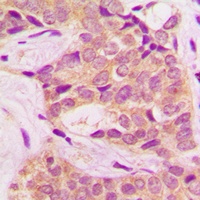 Anti-BCR (Phospho-Y360) Antibody