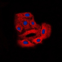 BCR (Phospho-Y360) antibody