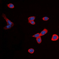 BDKRB1 antibody