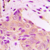 Anti-BMX Antibody