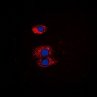 Anti-BMX Antibody