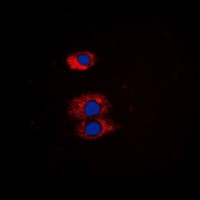 BMX antibody