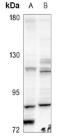 BMX Rabbit Polyclonal Antibody
