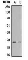 C1QG Rabbit Polyclonal Antibody