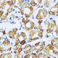 Anti-C1QG Antibody