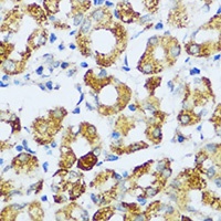 C1QC antibody