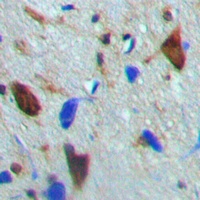 CaMK4 (Phospho-T200) Antibody