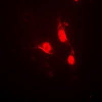 CAMK4 (Phospho-T200) antibody