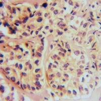 Anti-Calpain 11 Antibody