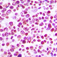 Anti-Caspase 3 (Phospho-S150) Antibody