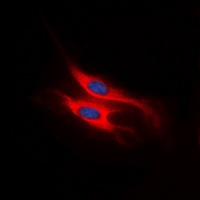 CCRL1 antibody