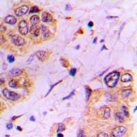 Anti-CDC25A (Phospho-S178) Antibody