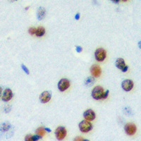 CDCA4 antibody