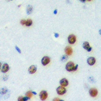 Anti-CDCA4 Antibody