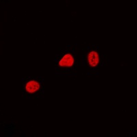 Anti-CDCA4 Antibody