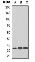 CDK2 Rabbit Polyclonal Antibody