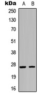 p27 Kip1 Rabbit Polyclonal Antibody