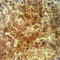 Anti-Cofilin Antibody