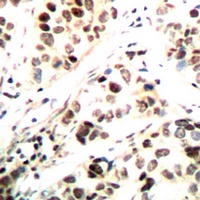 Anti-CHK1 (Phospho-S296) Antibody