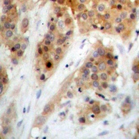 CHEK1 (Phospho-S345) antibody