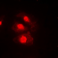 Anti-CHK1 (Phospho-S345) Antibody