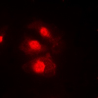 CHEK1 (Phospho-S345) antibody