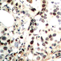 Anti-CHK2 (Phospho-T68) Antibody