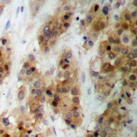 CMPK1 antibody