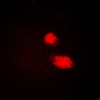 CMPK1 antibody