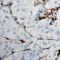 COL18A1 antibody