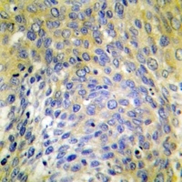 Anti-Collagen 4 alpha 6 Antibody