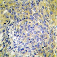 COL4A6 antibody