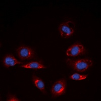 Anti-Collagen 4 alpha 6 Antibody