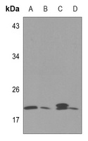 Zeta COP Rabbit Polyclonal Antibody