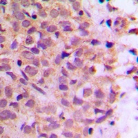 Anti-Zeta COP Antibody