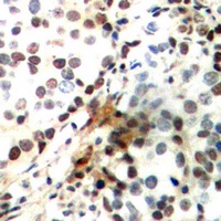 CREB1 (Phospho-S142) antibody