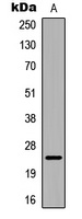 Alpha-crystallin B Rabbit Polyclonal Antibody