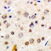 Alpha-crystallin B Rabbit Polyclonal Antibody