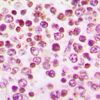 Anti-CD115 Antibody