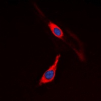 CSF1R antibody