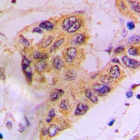 Anti-CK1 alpha (Phospho-Y294) Antibody